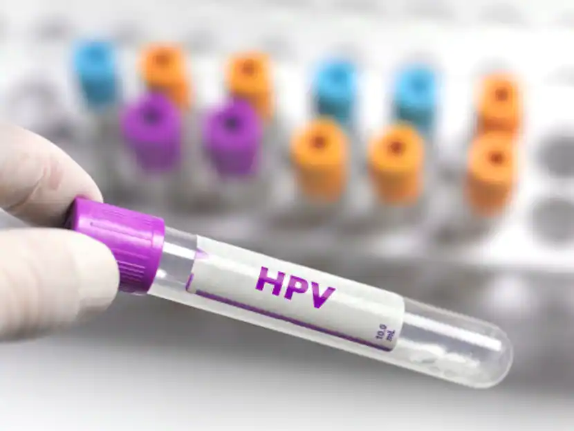 Serum Institute Developed Quadrivalent Human Papillomavirus Vaccine For Cervical Cancer Patients 9 To 26 Years